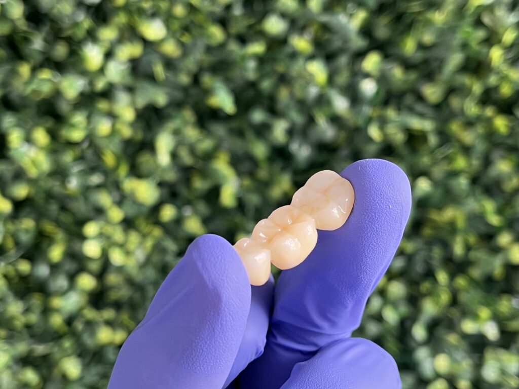 zirconia crowns merida mexico